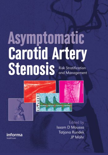 خرید و دانلود نسخه کامل کتاب Asymptomatic Carotid Artery Stenosis: A Primer on Risk Stratification and Management